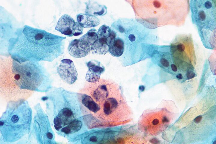 CYTOPATHOLOGY