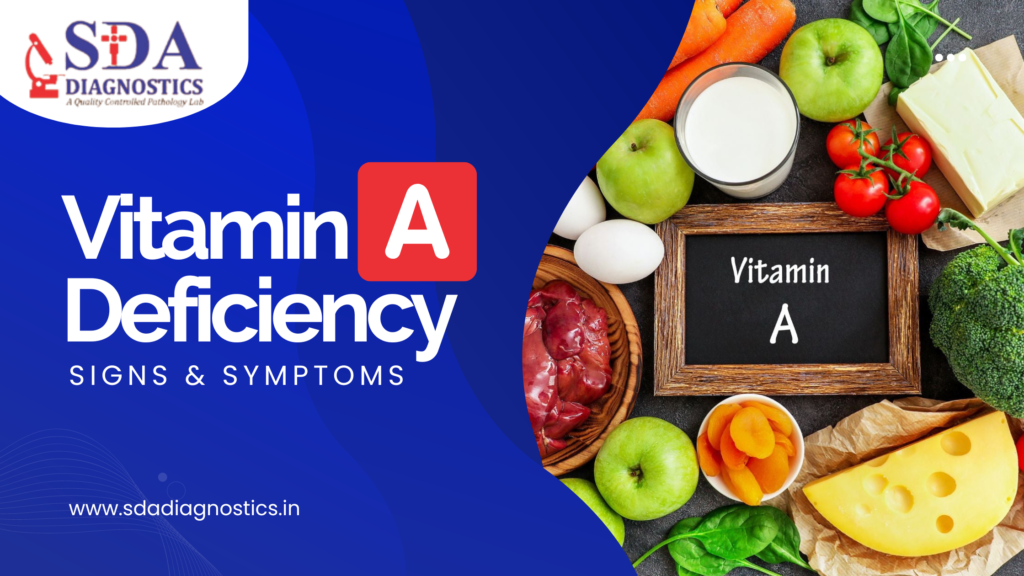 Vitamin A Deficiency: Signs & Symptoms