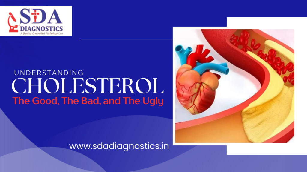 Cholesterol: The Good, The Bad, and The Ugly