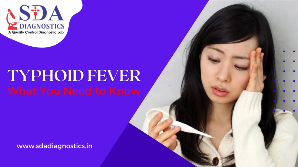 Typhoid Fever: What You Need to Know