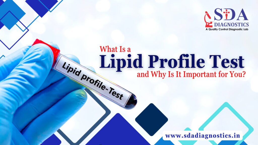 What Is a Lipid Profile Test and Why Is It Important for You?