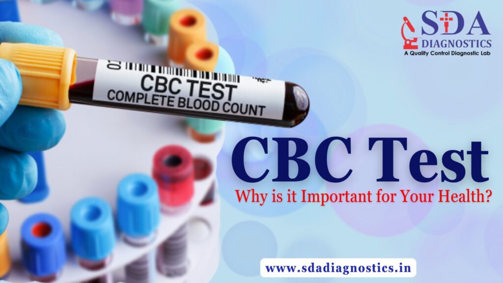 What is CBC Test and Why is it Important for Your Health?