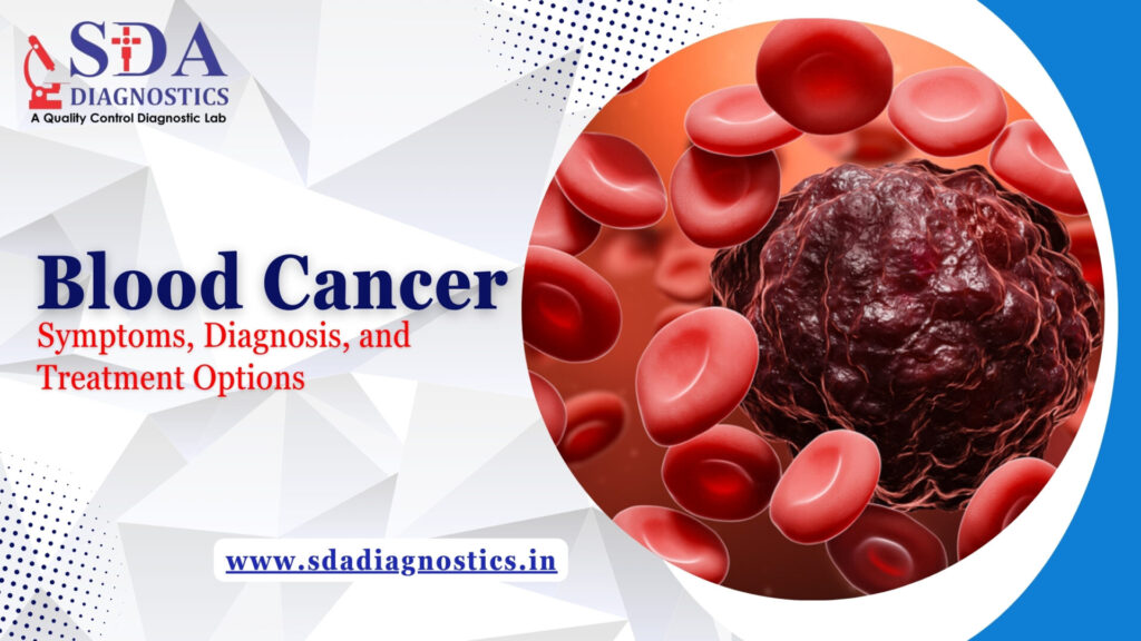 Blood Cancer: Symptoms, Diagnosis, and Treatment Options