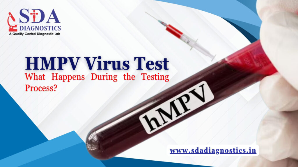 HMPV Virus Test: What Happens During the Testing Process?