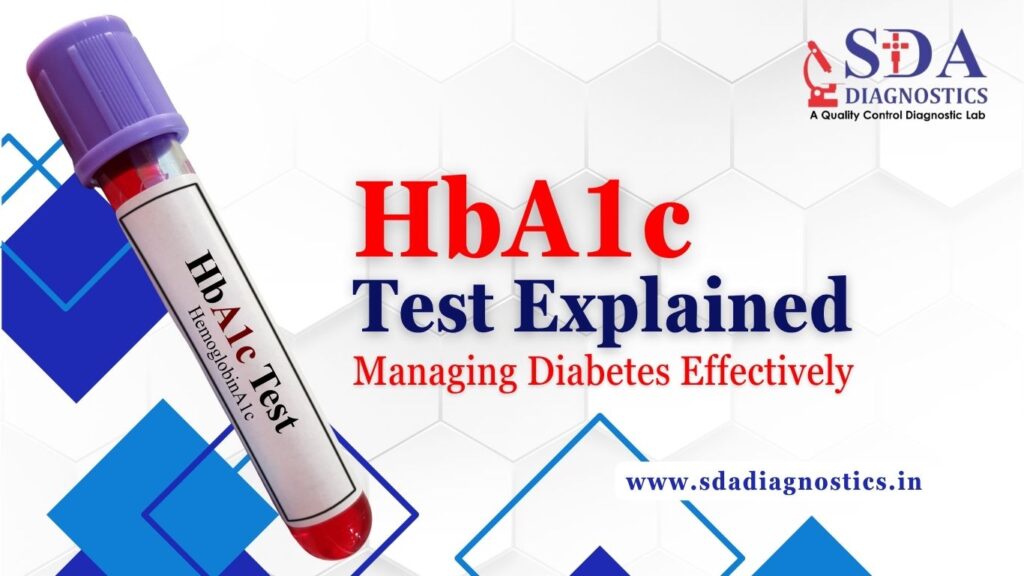 HbA1c Test Explained: Managing Diabetes Effectively