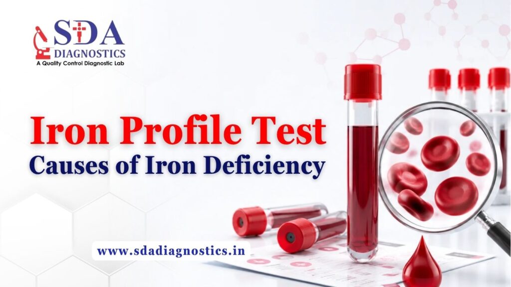 Iron Profile Test: Causes of Iron Deficiency